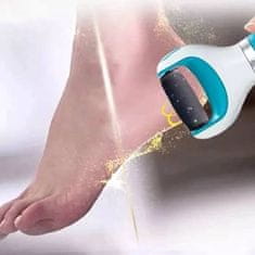 FRILLA® Električna pilica za stopala z vrtljivo glavo | SMOOTHFEET