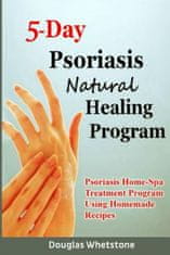5-Day Psoriasis Natural Healing Program: Psoriasis Home-Spa Treatment Program Using Homemade Recipes