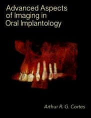 Advanced Aspects of Imaging in Oral Implantology