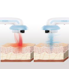 InnovaGoods 3-v-1 ultrazvočni kavitacijski anticelulitni masažer z infrardečo in elektrostimulacijo CellyMax InnovaGoods