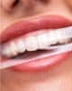 Mormark Trakovi za beljenje zob (7 kosov) | JOYSTRIPES