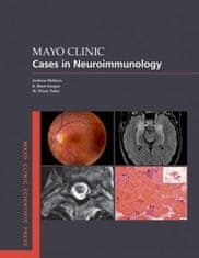 Mayo Clinic Cases in Neuroimmunology
