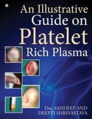 Illustrative Guide on Platelet Rich Plasma