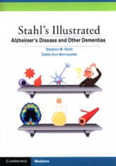 Stahl's Illustrated Alzheimer's Disease and Other Dementias