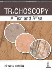 Trichoscopy