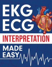 EKG ECG Interpretation Made Easy
