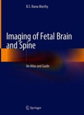 Imaging of Fetal Brain and Spine