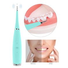 FRILLA® TEETHLY: Ultrazvočni čistilec zob SMILY + korekcijski serum V34 JOYTEETH