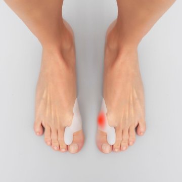UNBRANDED Silikonski zaščitni korektor bunion Bunilief InnovaGoods Pakiranje 2 enot