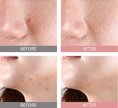 MIZON Pink Spot Good Bye Blemish (Overnight Spot Care ) nočni serum 19 ml
