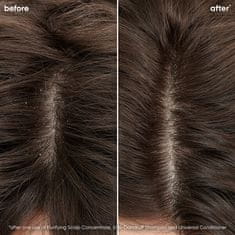 Biolage Scalp Sync (koncentrat za čiščenje lasišča) 200 ml