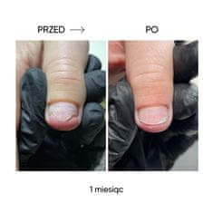 shumee NAILSOFTHEDAY ONISTOP - regeneracijsko olje za nohte z oniholizo, 8 ml