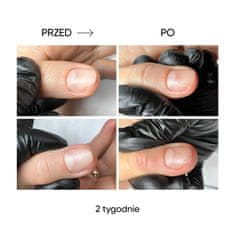 shumee NAILSOFTHEDAY ONISTOP - regeneracijsko olje za nohte z oniholizo, 8 ml