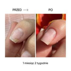 shumee NAILSOFTHEDAY ONISTOP - regeneracijsko olje za nohte z oniholizo, 8 ml