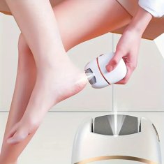 FRILLA® Električni brusilnik, ki hitro odstrani otiščance | PETAGRIND