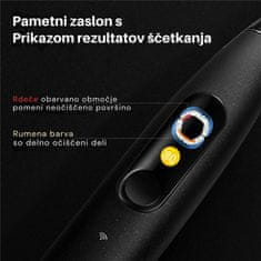 Oclean Električna zobna ščetka X Ultra 20 Set Črna, Sonični motor
