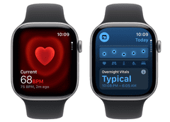 Apple Watch Series 11 pametna ura, GPS, 42mm, + pašček M/L, siv (Space Grey) (MEQW4WF/A)