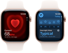 Apple Watch Series 11 pametna ura, GPS, 42mm + pašček, M/L, bež (Rose Gold) (MEU44WF/A)