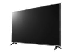 shumee LG | 55UQ751C0LF | Brezžično omrežje