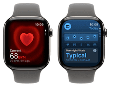 Apple Watch Series 11 pametna ura, GPS + Cellular, 46mm + pašček, M/L, titan (Natural Titanium) (MFCX4WF/A)