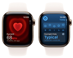 Apple Watch Series 11 pametna ura, GPS + Cellular, 46mm + pašček M/L, Gold Titanium (MFD64WF/A)