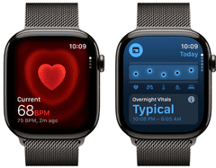 Apple Watch Series 11 pametna ura, GPS + Cellular, 46mm + pašček, M/L, Slate Milanese (MFD44WF/A)