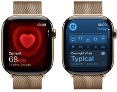 Apple Watch Series 11 pametna ura, GPS + Cellular, 46mm + pašček M/L, Gold Milanese (MFD84WF/A)