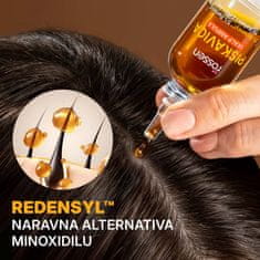 ROSSEN Natural Ampula za lasišče – piskavica