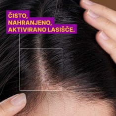 ROSSEN Natural Losjon proti mastnim lasem