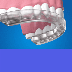 shumee Sprostitvena opornica za bruksizem, komplet 5 kosov