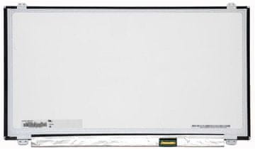 CoreParts 15,6"" LCD HD mat