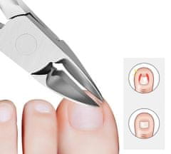 shumee Ščipalke za vraščene nohte, ščipalke za obnohtno kožico, natančne, ostre