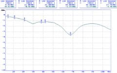 shumee D-SEP2/HD VIDEO LOČEVALNIK