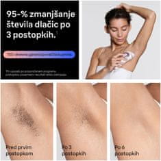 Braun Silk Expert PL 7321 laserski odstranjevalec dlak