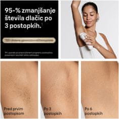 Braun Silk Expert PL 5431 laserski odstranjevalec dlak