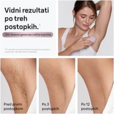 Braun Silk Expert PL 1111 laserski odstranjevalec dlak