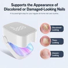 Netscroll Naprava za nego nohtov z modro svetlobo 460 nm, nega nohtov pri glivičnih spremembah, obarvanih nohtih, zadebeljenih nohtih, RepairNail.
