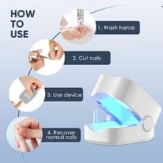 Netscroll Naprava za nego nohtov z modro svetlobo 460 nm, nega nohtov pri glivičnih spremembah, obarvanih nohtih, zadebeljenih nohtih, RepairNail.
