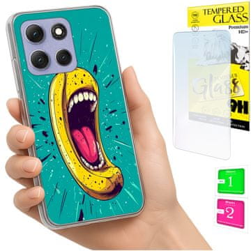 shumee Ovitek za Motorola Moto G86 Power FOTO ovitek banana + 9H steklo