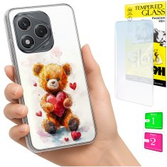 shumee Ovitek za Honor 400 Lite FOTO zadnja stran grafični medvedek + 9H steklo