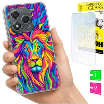 shumee Ovitek za Honor 400 Lite FOTO zadnja stran grafike lev + 9H steklo
