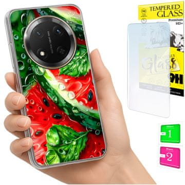 shumee Ovitek za Honor Magic7 Lite FOTO zadnja stran grafike lubenica + STEKLO