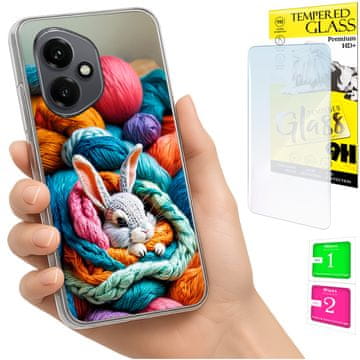 shumee Ovitek za Honor X7d / 400 Smart FOTO ovitek za hrbtno stran Rabbit + 9H STEKLO
