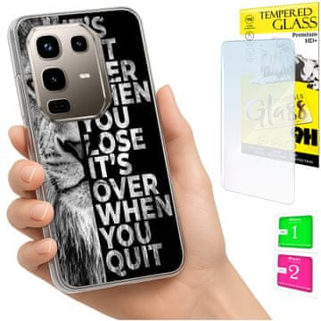 shumee Ovitek za INFINIX Note 50 Pro 4G FOTO ovitek + 9H STEKLO