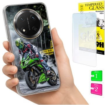 shumee Ovitek za Honor Magic7 Lite FOTO ovitek zadnji ovitek + 9H steklo
