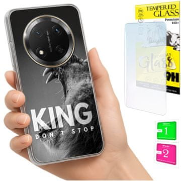 shumee Ovitek za Honor Magic7 Lite FOTO zadnja stran + 9H steklo
