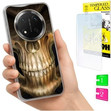 shumee Ovitek za Honor Magic7 Lite FOTO zadnja stran + 9H steklo