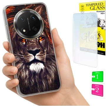 shumee Ovitek za Honor Magic7 Lite FOTO zadnja stran + 9H steklo