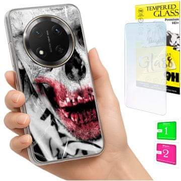 shumee Ovitek za Honor Magic7 Lite FOTO zadnja stran + 9H steklo