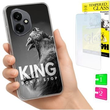 shumee Ovitek za Honor X7d / 400 Smart Housing FOTO ovitek zadnja stran + 9H STEKLO